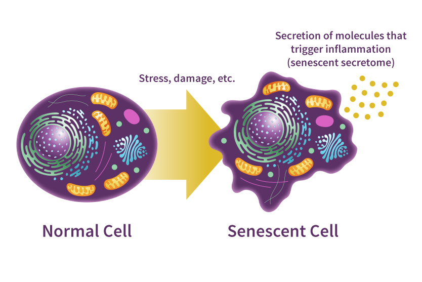 Normal cell, senescent cell