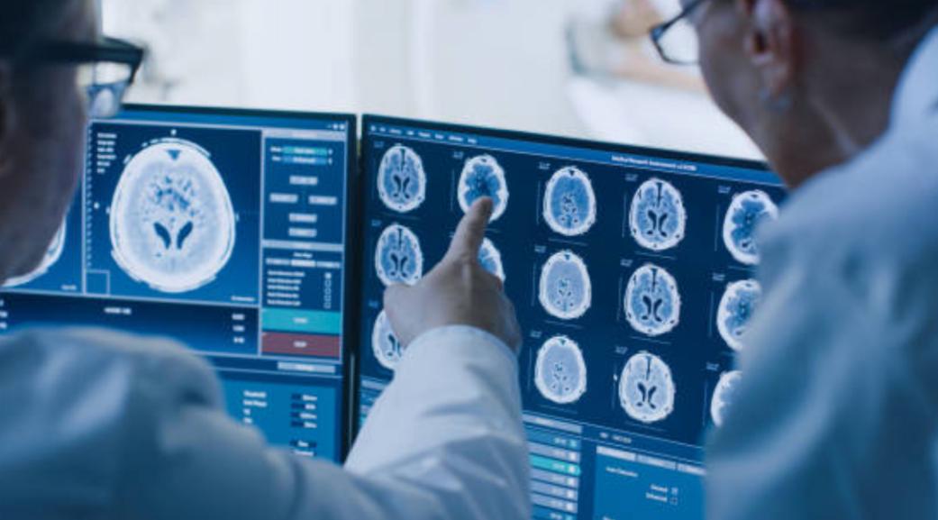 Doctors looking at brain scans.